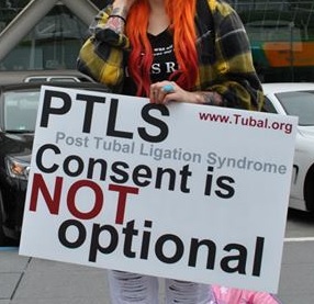 Tubal ligation informed consent is NOT optional.