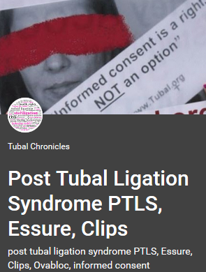 Post Tubal Ligation Syndrome PTLS, Essure, Clips post tubal ligation syndrome PTLS, Essure, Clips, Ovabloc, informed consent